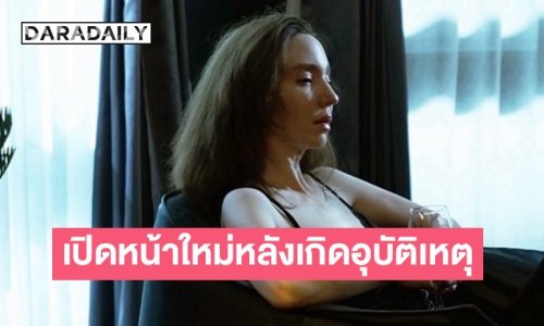 “คลาวเดียร์” เปิดหน้าใหม่ หลังหน้าฟาดพื้นเย็บเกือบ 40 เข็ม จมูกหักจนต้องทำใหม่