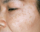 เครื่องสำอางเป็นพิษ  ใครควรจะรับผิดชอบ