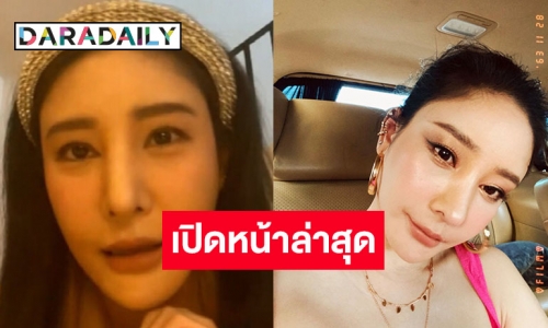 "แตงโม นิดา" เผยหน้าล่าสุด พร้อมเปิดใจปมศัลยกรรมทำพิษ