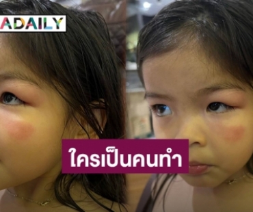 สุดเอ็นดู! “น้องมีญ่า” ลูกสาว “มาร์กี้” หน้าบวมเพราะ??