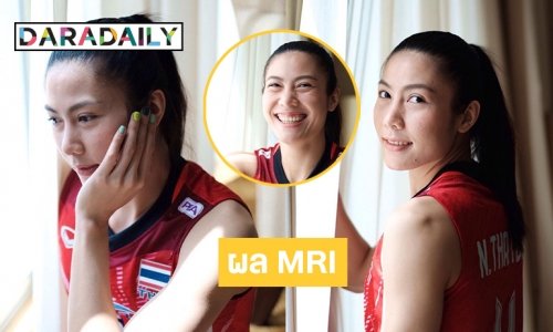 ผล MRI "ทัดดาว นึกแจ้ง” แพทย์วินิจฉัยแบบนี้