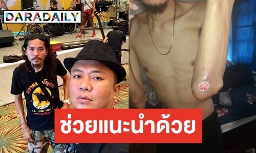 "อี๊ด โปงลาง" วอนผู้รู้ขอความช่วยเหลือรักษา "เควิน" หลังป่วยหนัก