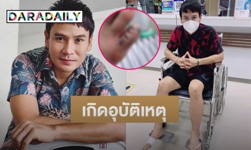 “ไผ่ พงศธร” เกิดอุบัติเหตุถูกเก้าอี้ไม้ล้มทับทิ้วเท้า เย็บ 5 เข็ม