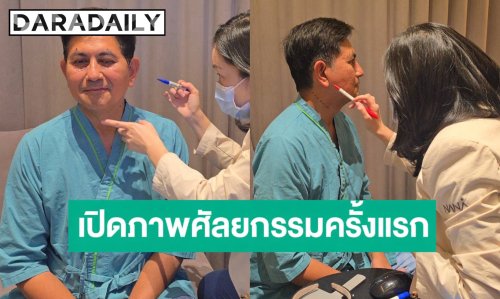 “ดุ๊ก ภาณุเดช” เปิดหน้าหลังศัลยกรรมครั้งแรกในชีวิต ดูเด็กลงมาก
