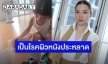 “ดีเจต้นหอม” โพสต์ป่วยเป็นโรคผิวหลังประหลาด ถามช่วยแนะนำหมอเก่งๆ
