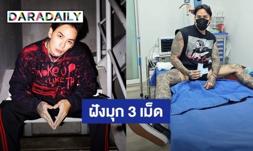 “แทค ภรัณยู” ฝังมุก 3 เม็ด ชาวเน็ตแห่ขอดูรีวิวเพียบ!