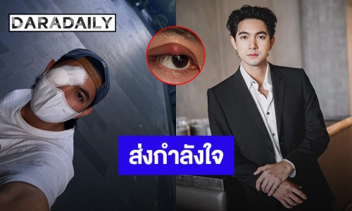 แฟนๆส่งกำลังใจ “เข้ม หัสวีร์” ลงภาพปิดตา 1 ข้าง
