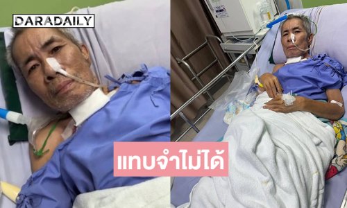 น่าตกใจตลกดังป่วยหนักเห็นภาพแทบจำไม่ได้