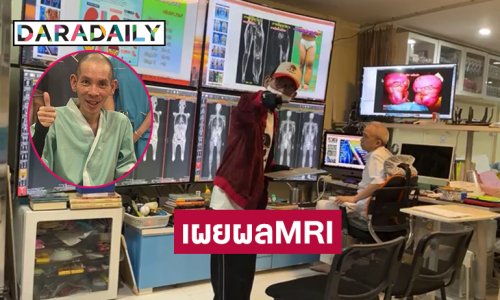 ไลฟ์สดกับแพทย์เผยผลMRI ของศิลปินป่วยตุ่มน้ำพองครั้งแรก