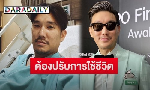 “บุรินทร์” อัปเดตอาการลำไส้อักเสบเรื้อรัง  โอดใช้เวลาผ่าตัดด่วนนานกว่า 6 ชม.
