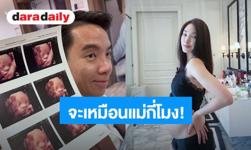 “เมย์ พิชญ์นาฏ” โชว์ภาพอัลตร้าซาวด์ลูกชาย ถามจะเหมือนแม่กี่โมง?!