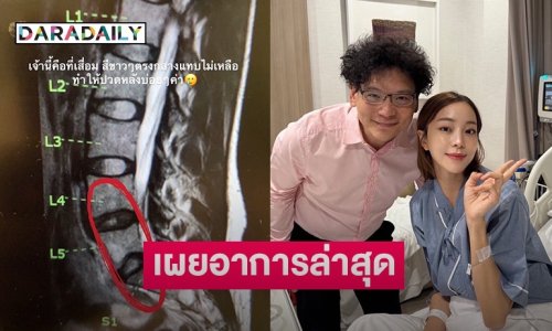 แฟนๆ ส่งกำลังใจ “นิวเคลียร์” โพสต์ภาพภาพเอ็กซเรย์ พร้อมแจ้งอาการล่าสุด