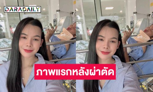 ภาพแรก “ด้งเด้ง ณัฐวุฒิ” หลังผ่าตัด สามารถหายใจได้เอง