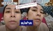 “ใหม่” โชว์หน้าสดแพ้ท้อง 2 หนักมาก แต่เจอคนทักสิวขึ้นเยอะน่ากลัว เลยตอกกลับแบบนี้!