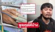 อัปเดตอาการ “ด้งเด้ง” ถอดเครื่องช่วยหายใจ พูดคุยได้บ้าง