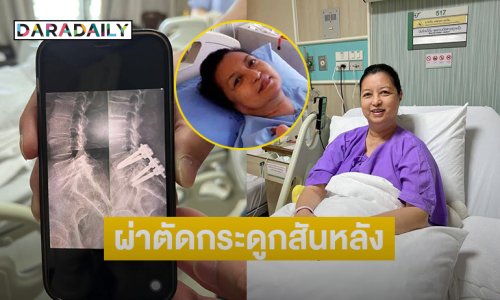 วิกฤตชีวิตดารารุ่นใหญ่เล่าระทึกเข้ารับการผ่าตัดกระดูกสันหลัง