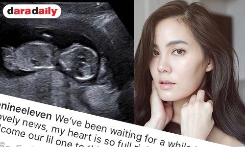 ว่าที่คุณแม่ “เจนี่” เบบี๋มาเคาะประตูแล้ว