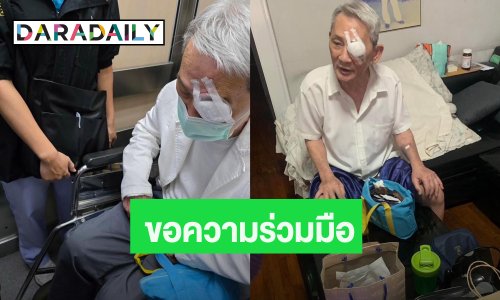 เปิดสาเหตุ “คุณพ่อ” ของ “บิ๊ก ดีทูบี” ปิดตา ขอความร่วมมือในการทำสิ่งนี้!