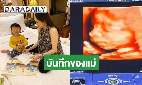 “แยม ธมลพรรณ์” โพสต์ภาพอัลตราซาวด์ เบบี๋คนต่อไปใกล้คลอดแล้ว!