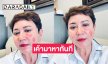 ดารารุ่นใหญ่เป็นผื่นแดงขึ้นแก้มน่ากลัวด้วยเหตุนี้
