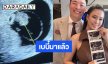 “ปาย สิตางศุ์” โพสต์ภาพอัลตร้าซาวด์ประกาศข่าวดี เบบี๋มาแล้ว