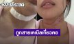 นางงามคนดังเล่านาทีชีวิต ถูกสายเคเบิลเกี่ยวคอหวิดขาด 