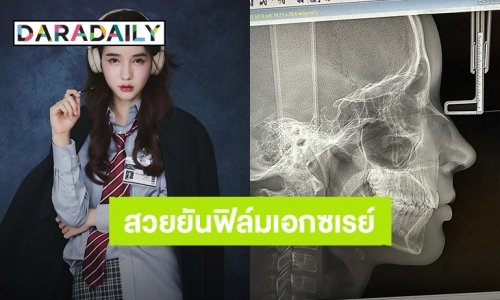 ชาวเน็ตตะลึ่งความงาม! “โยชิ รินรดา” สวยยันฟิล์มเอกซเรย์ กระดูกคอยังดูดี