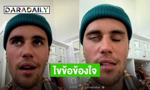 ไขข้อข้องใจอาการใบหน้าอัมพาตครึ่งซีกของ “จัสติน บีเบอร์”