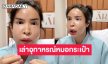 ช็อก “นัท นิสามณี” ผ่าตัดดูดหนอง หลังหน้าบวมจากการฉีดกับหมอกระเป๋า