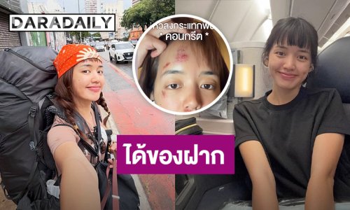 ยูทูบเบอร์ดัง ประสบอุบัติเหตุล้มหน้ากระแทกพื้น