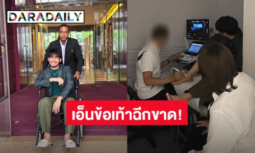 แฟนคลับส่งกำลังใจ “อาโป ณัฐวิญญ์” ประสบอุบัติเหตุตกบันไดเอ็นข้อเท้าฉีกขาด!