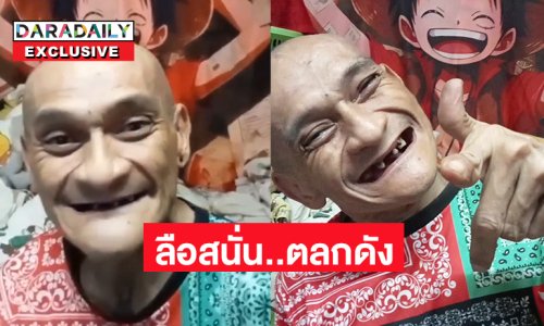 โต้ข่าวลือเสียชีวิต!!ตลกดังเดินไม่ได้แล้ว