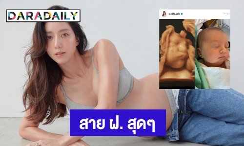 เปิดหน้าชัดๆ! “น้องเลอา” ลูกสาว “แม่ไอซ์ อภิษฎา” โฟกัสจมูกโด่งสุดๆ