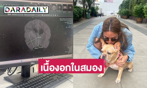 นักร้องดังช็อก! พบเนื้องอกในสมอง “เจ้าบานี่”