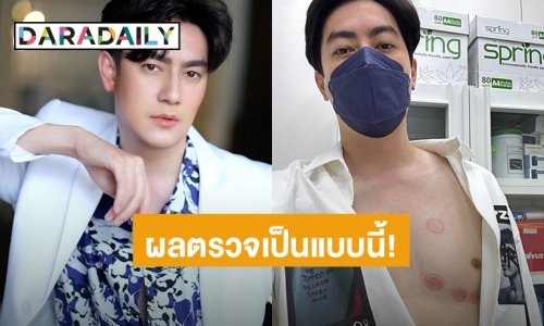 ผลตรวจเป็นแบบนี้! “ฟิล์ม รัฐภูมิ” ตรวจเช็คร่างกายหลังผ่าตัดลิ้นหัวใจรั่วระยะสุดท้ายครบ 3 เดือน 