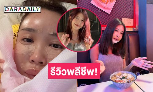 รีวิวพลีชีพ! นางเอกซีรีส์ดังรับหน้าเบี้ยวไปศัลยกรรมชีวิตเกือบพัง
