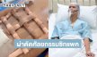 นักแสดงหนุ่มโชว์หุ่นแซ่บ หลังเข้าผ่าตัดศัลยกรรมซิกแพค