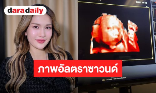 มาแล้ว! ภาพอัลตราซาวนด์ลูกสาว “ฟารีดา” อายุครรภ์ 24 สัปดาห์ โครงหน้าชัด แก้มยุ้ย-จมูกโด่ง