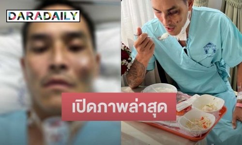 เปิดภาพล่าสุด “สงกรานต์” เริ่มทานอาหารเองได้แล้ว หลังจากทานของเหลวผ่านสายจมูกมา 7 วันเต็ม