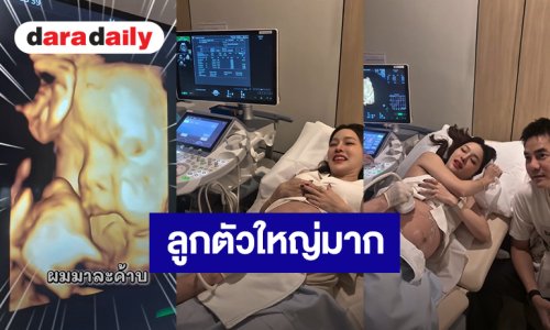 “แอร์ ภัณฑิลา” อัลตร้าซาวด์ลูกชายในท้อง ตัวใหญ่มากหนัก 2.8 กิโล