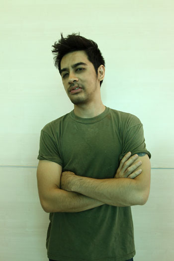 “ออย” หมดหล่อเจ็บปากแหว่งโจรหน้าบาก