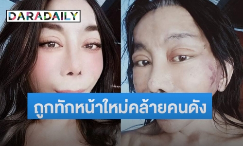 “แม่สิตางศุ์” อวดภาพล่าสุดหลังทำศัลยกรรม ทำชาวเน็ตเทียบดาราคนนี้