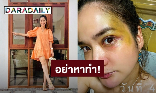 อย่าหาทำ! “ปอย ปวีณา” เล่นสเก็ตบอร์ดไม่ใส่เครื่องป้องกัน หน้าฟาดพื้นไม่รู้ตัว
