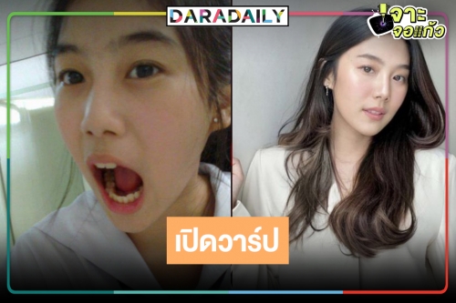 เปิดประวัติ “สไมล์ ภาลฎา” สาวสวยสดใสเจ้าแม่ละครเย็น