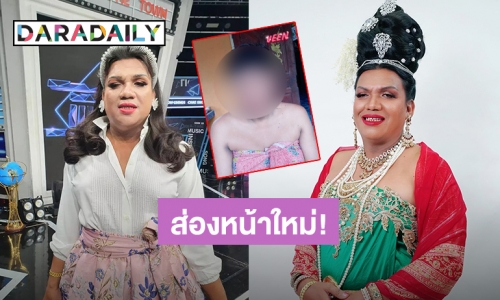 ออกมาสวยแน่! อัปเดทใบหน้า “พระมหาเทวีเจ้า” หลังศัลยกรรมได้ 2 วัน