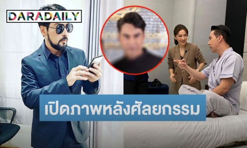 มาแล้ว! ภาพ “จอนนี่ แอนโฟเน่” หลังเข้าศัลยกรรมแก้ไขใบหน้าครบ 7 วัน