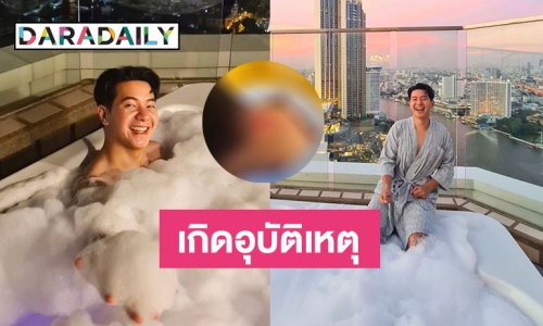 หวาดเสียว! “ไอซ์ ศรัณยู” เล่าเกิดอุบัติเหตุหงายหลังคอกระแทก ตึกชั้น 36