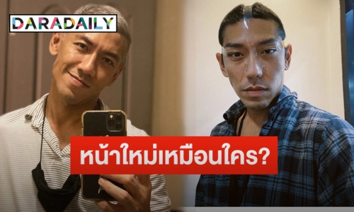 ยลโฉม “ป๋อมแป๋ม” หลังขึ้นเขียงศัลยกรรมใบหน้า