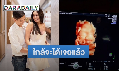 “เตย กัญญกร” โชว์ภาพอัลตราซาวด์ลูกสาวตัวน้อย พร้อมเผยชื่อสุดน่ารัก