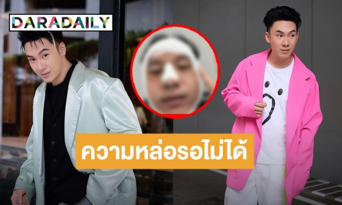 เตรียมดูหน้าใหม่! “ตั้ม วราวุธ” ขึ้นเขียงศัลยกรรม